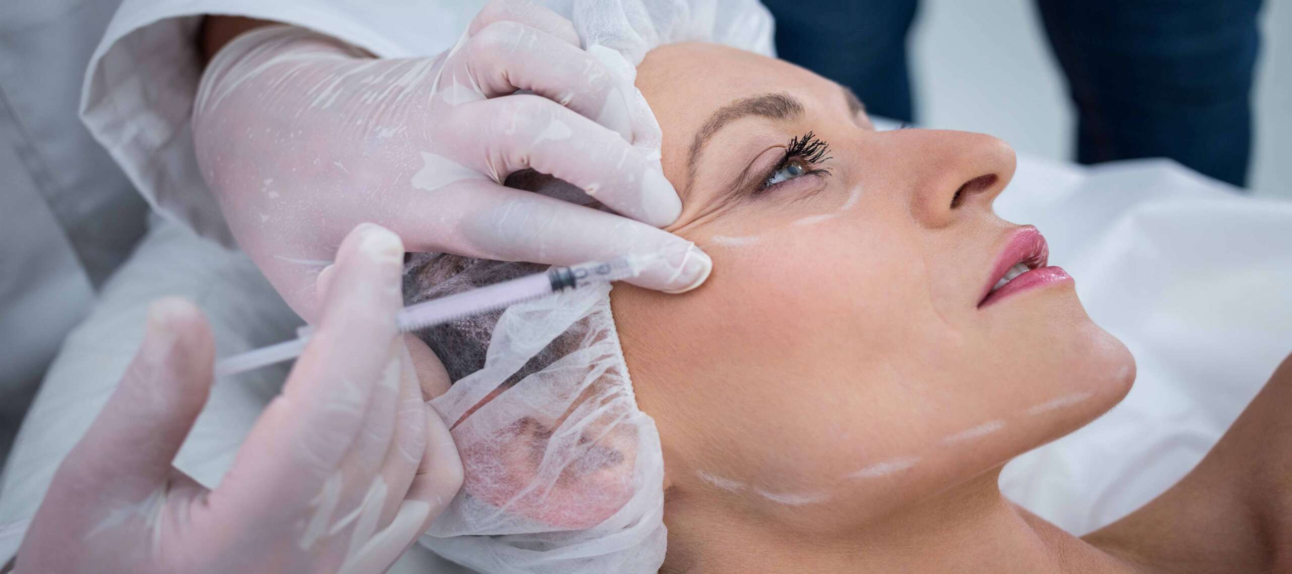 Botox and Filler treatment